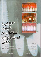 کتاب افزایش و تقویت استخوان در ایمپلنتولوژی دهان -رنگی  محمدرضا کریمی - کاملا نو